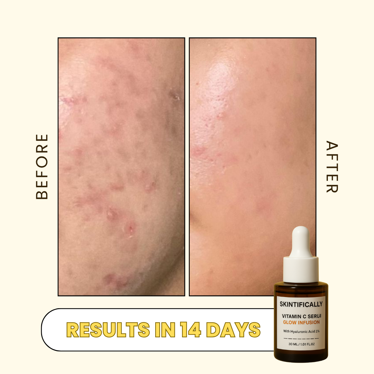Vitamin C Serum