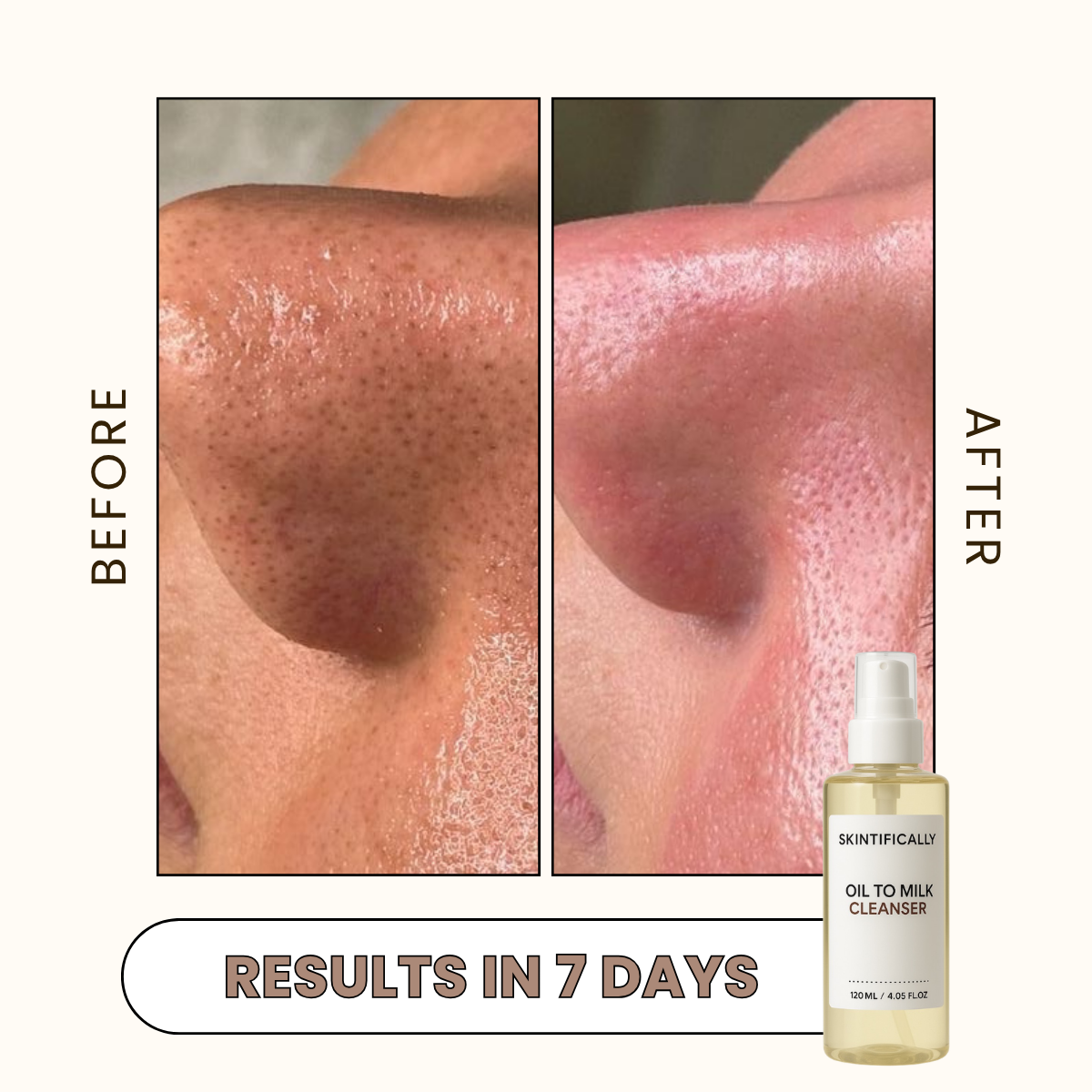 Oil To Milk Cleanser