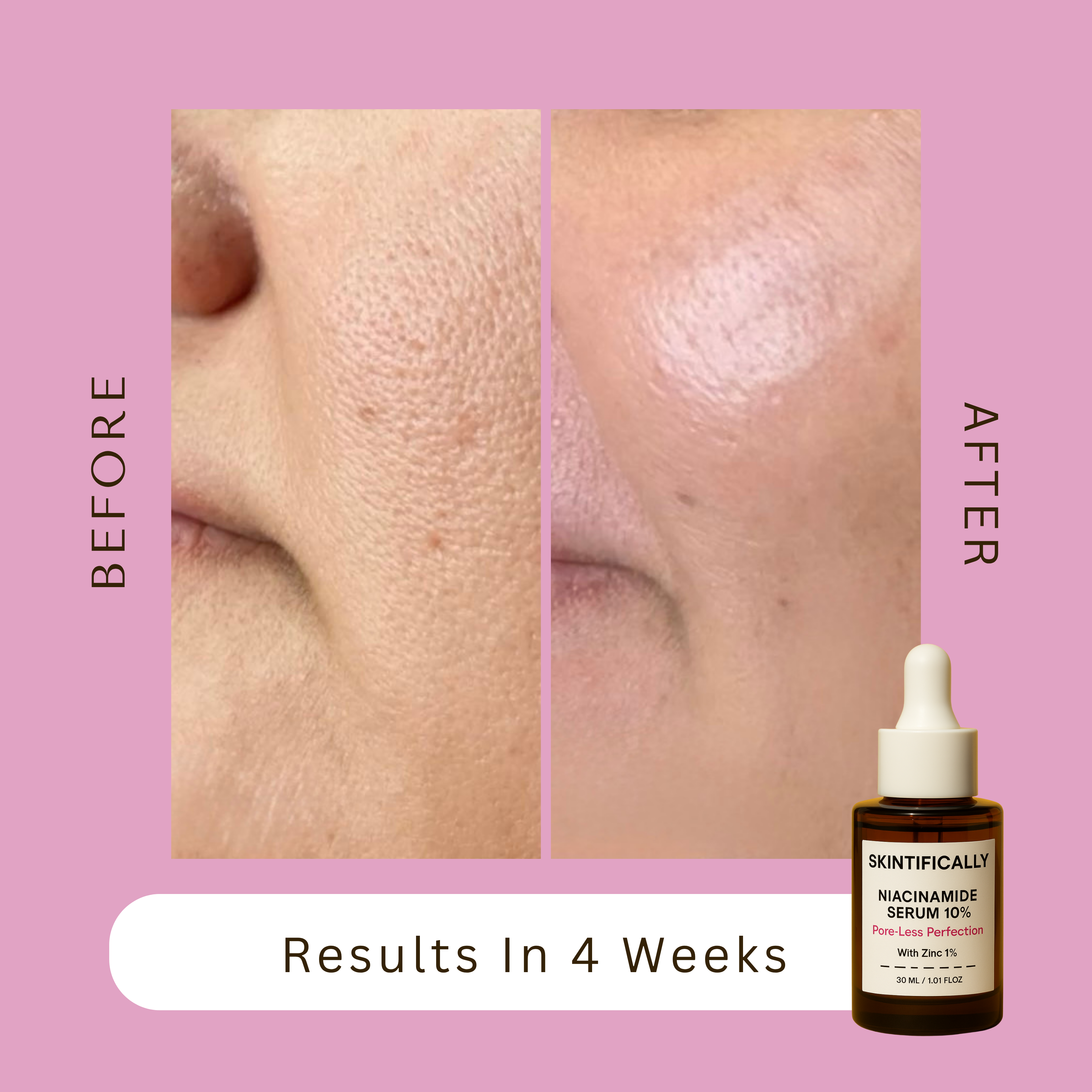Pore-Less Perfection Niacinamide Serum