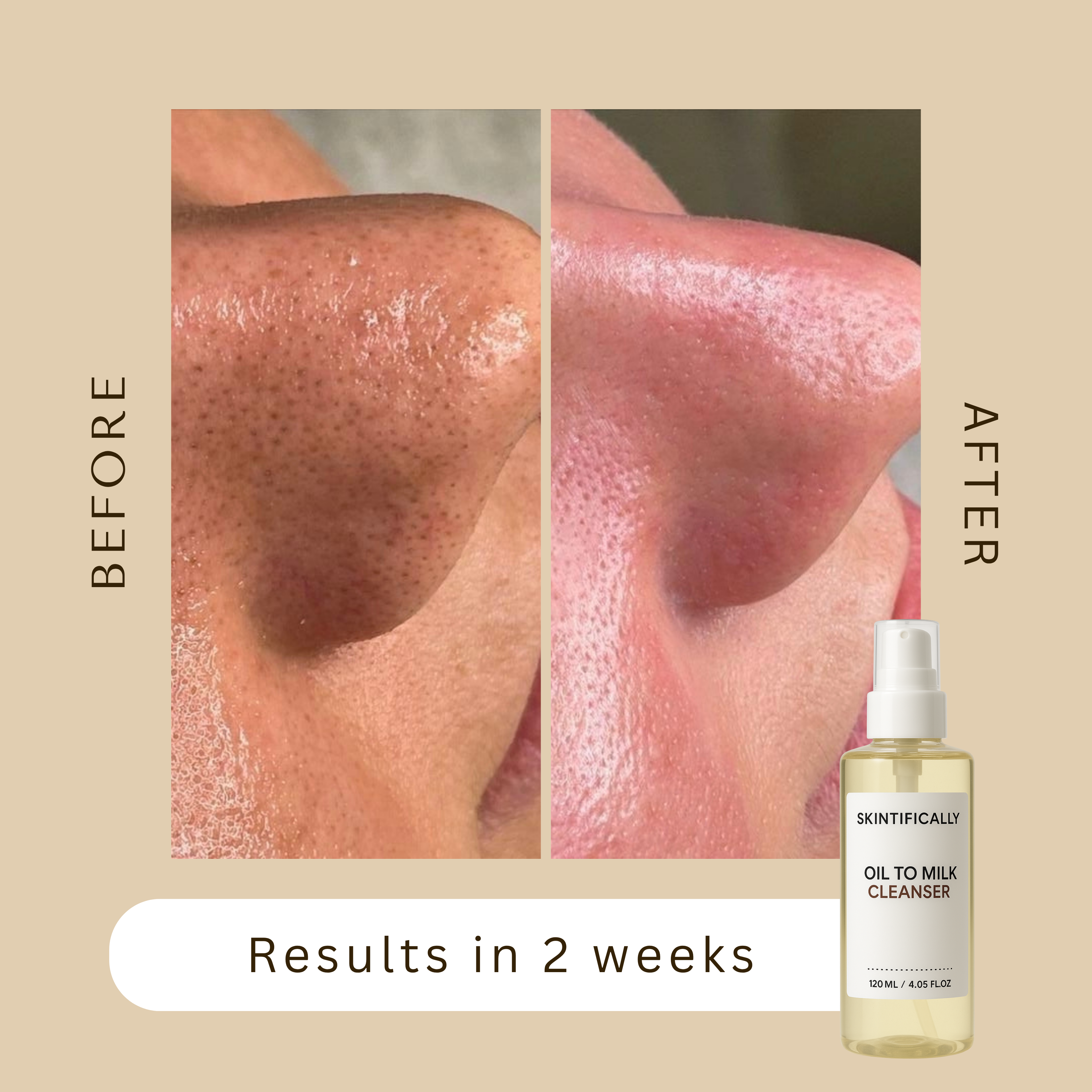 Oil To Milk Cleanser
