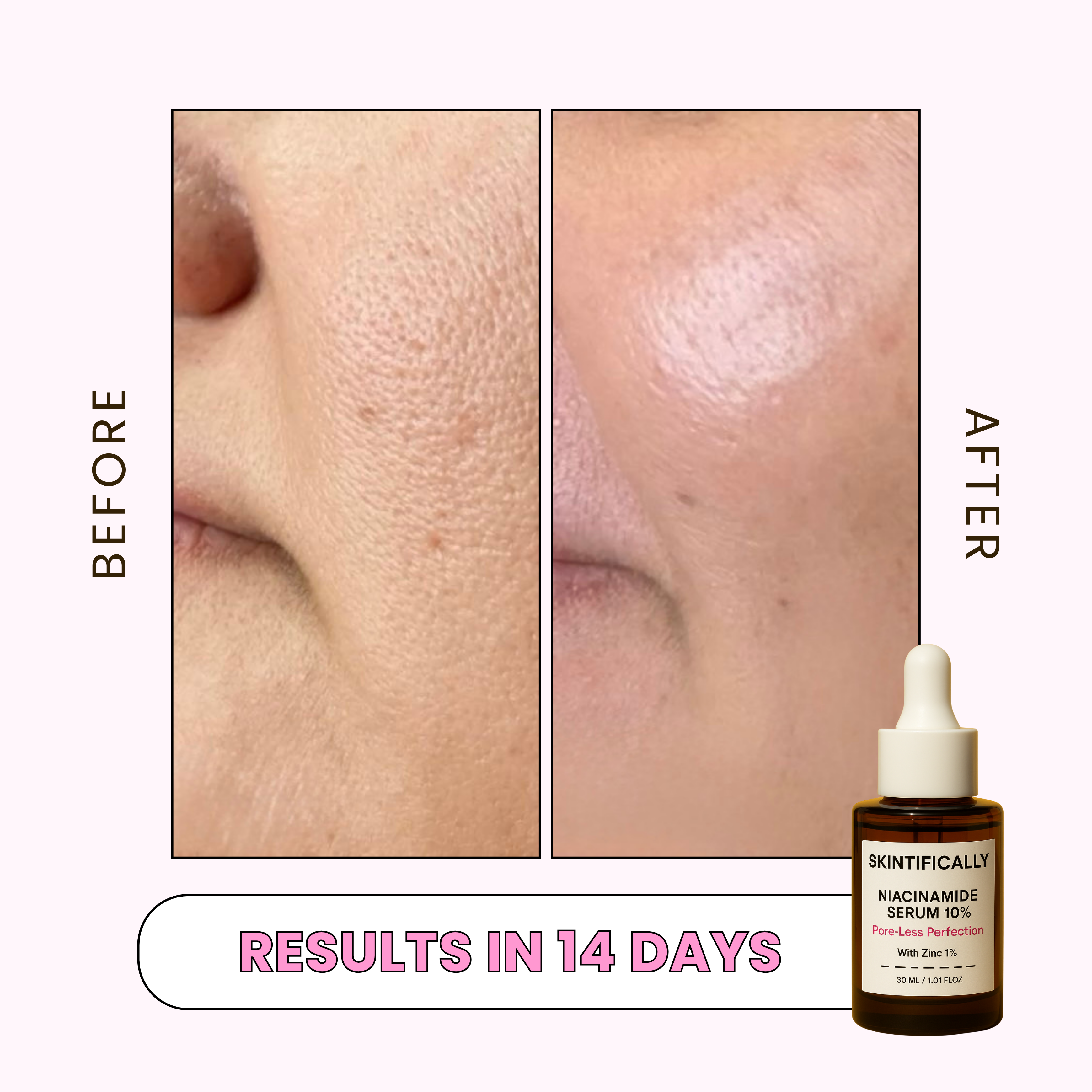 Pore-Less Perfection Serum