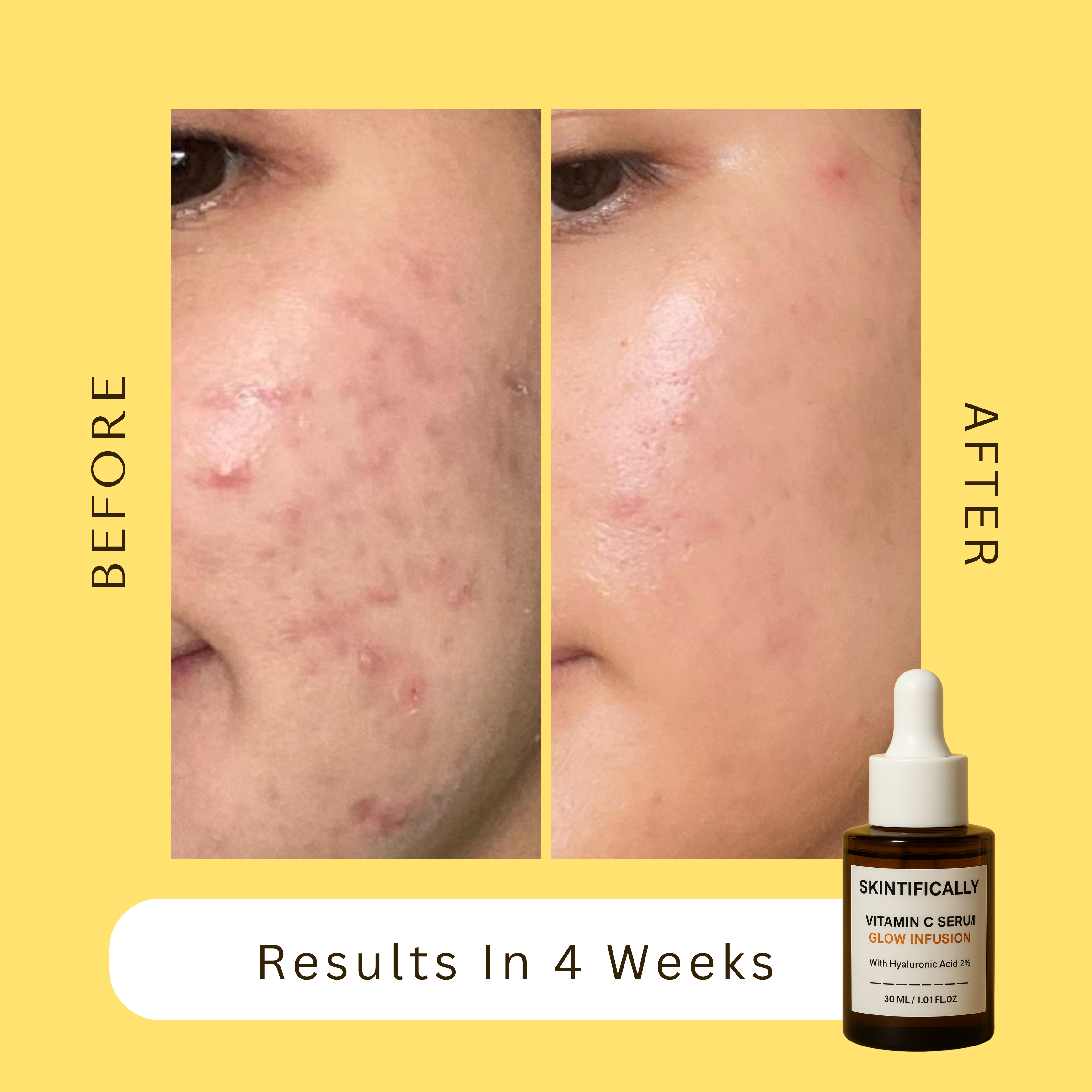 Brightening Vitamin C Serum